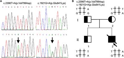 Novel Compound Heterozygous TMPRSS15 Gene Variants Cause Enterokinase Deficiency